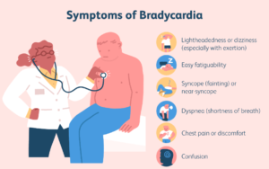 How to Treat Symptomatic Bradycardia: A Comprehensive Guide